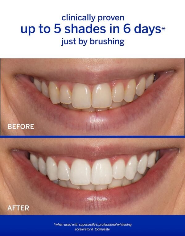 Supersmile Whitening Accelerator – 3.6 oz - Image 2